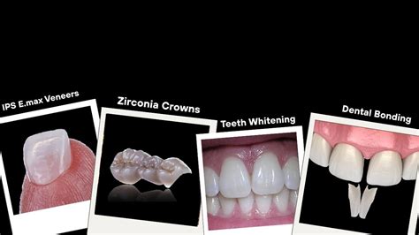 Best Restoration for Anterior (Front) Teeth Smile Design