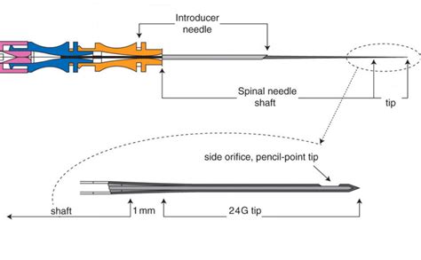 Medrop Spinal needle 24G Pack of 10 Medical Needle (Purple) : Amazon.in ...