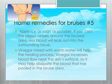 Home Remedies Presentation | PPTX