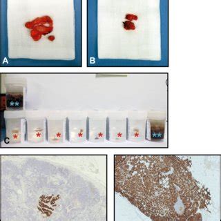 Image result for Mutilate Tissue Sample