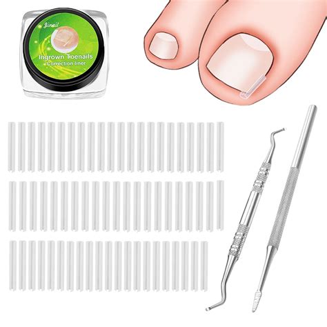 Buy (60+2) Pack Ingrown Toenail Correction Treatment Kit, 60PCS Ingrown ...