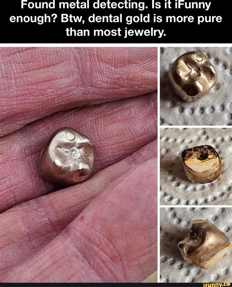 Found metal detecting. Is it Funny enough? Btw, dental gold is more pure than most jewelry. - iFunny