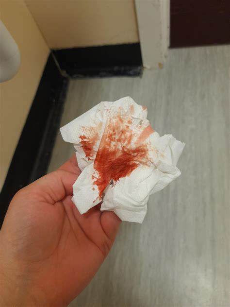 Period Blood On Toilet Paper