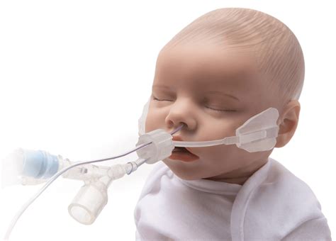 ArcAngel™ Neonatal & Pediatric Endotracheal Tube - WarriorNP