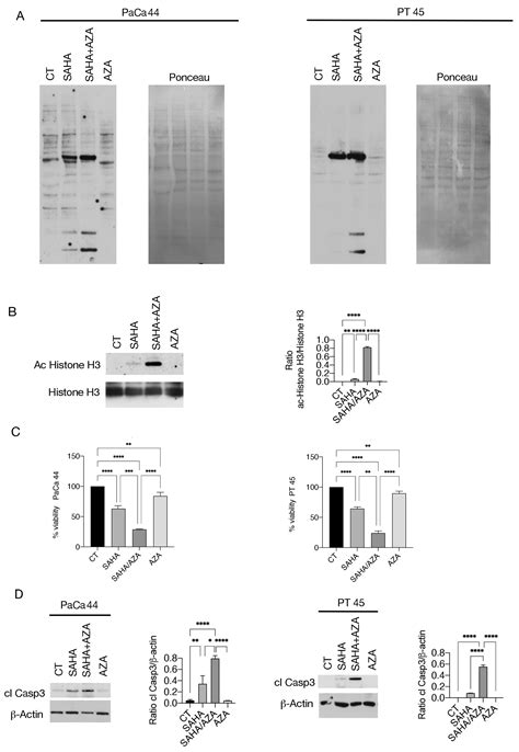 SAHA/5-AZA Enhances Acetylation and Degradation of mutp53, Upregulates ...