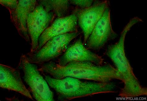 5 Lipoxygenase antibody (10021-1-Ig) | Proteintech