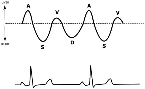 Novel Methods for Predicting Fluid Responsiveness in Critically Ill ...