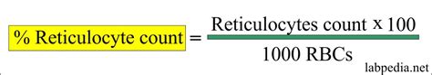 Image result for Retics Count by Flow Cytometry