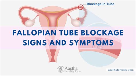 Image result for Fallopian Tube Blockage Surgery