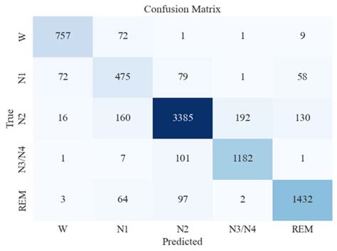 Temporal Feature Extraction and Machine Learning for Classification of ...