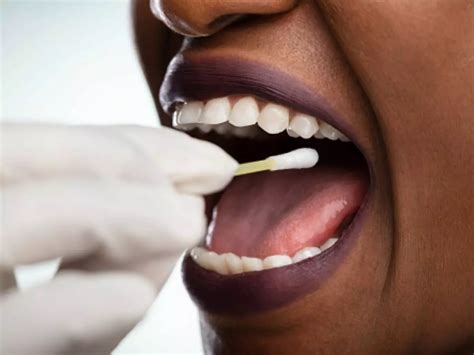 Uric Acid In Saliva Could Help Diagnose Cancer And Diabetes, Say Indian ...