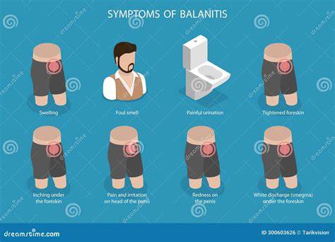 3D Isometric Flat Vector Illustration of Symptoms of Balanitis Stock Vector - Illustration of ...