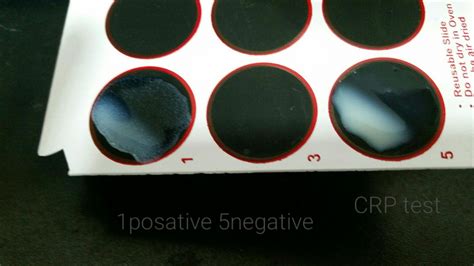 What Color Tube Is Used For Crp Test at Christopher Larochelle blog