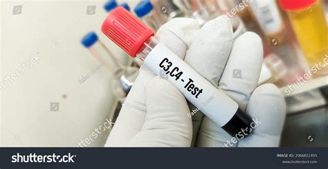 Image result for C4 Complement Blood Test