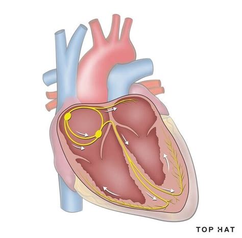 Image result for Cardiac Conduction System Disorders