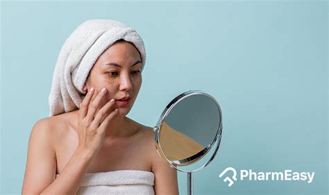 Best Home Remedies for Hyperpigmentation | PharmEasy