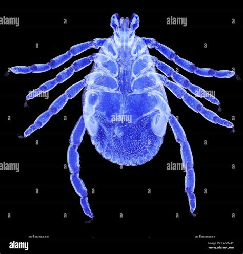 American dog tick (Dermacentor variabilis), light micrograph (LM) from a whole mount. This ...