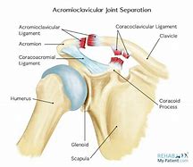 Image result for Acromioclavicular