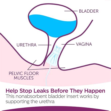 Tampons For Leaky Bladder at Olivia Quinn blog