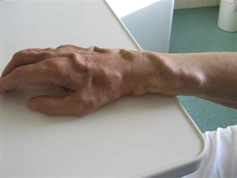 Hand Veins In Wrist at Lloyd Sutton blog