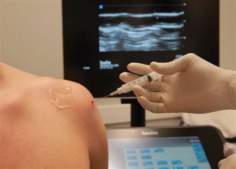 Image result for Ultrasound-Guided Injection Fluoroscopy