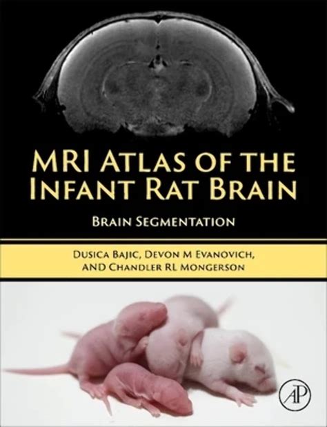 Buy MRI Atlas of the Infant Rat Brain: Brain Segmentation Book Online ...