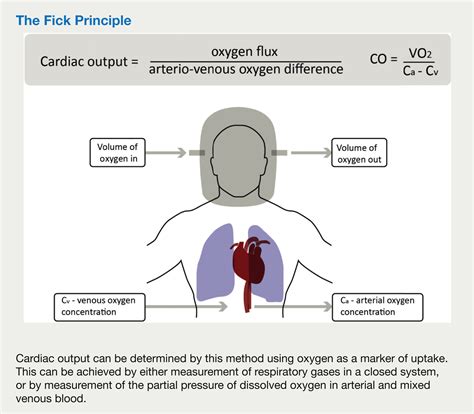 Cardiac output measurement - Anaesthesia & Intensive Care Medicine