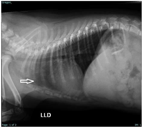 Clinical Approach to Cleft Lip and Palate with or Without Surgical ...