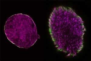 Hybrid hydrogel system to heal broken bones