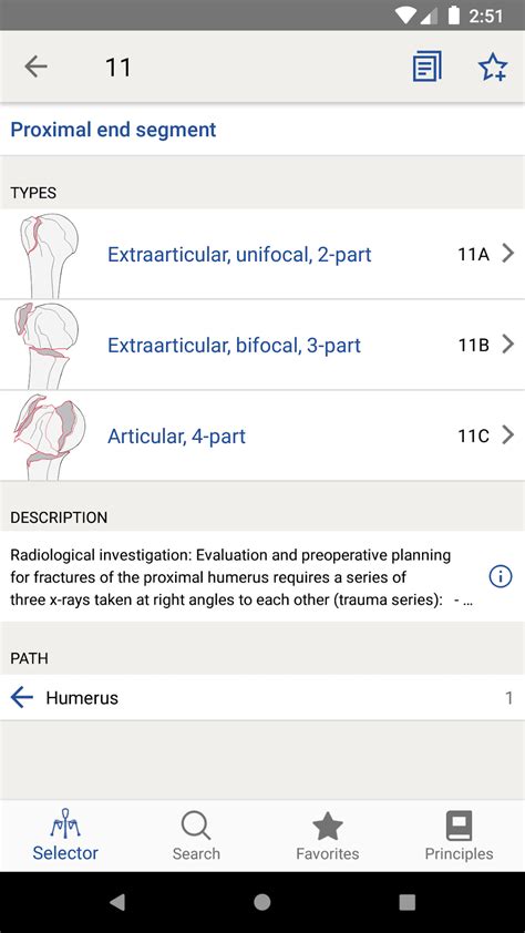 Image result for Fracture Classification System
