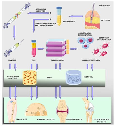 Adipose-Derived Mesenchymal Stromal Cells: A Tool for Bone and ...