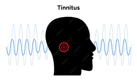 Image result for Stimulus Control Transfer ABA Example