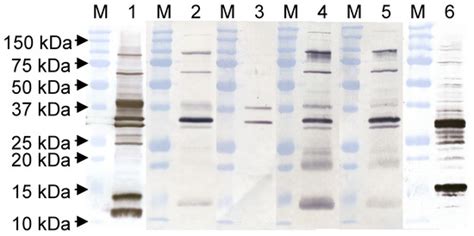 Vaccines | Special Issue : Poxvirus Mediated Immunity in Infection and ...