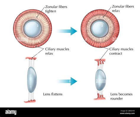Suspensory Ligament Eye