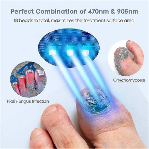 2024 Nail Fungus Laser Treatment Device for Multiple Toenail, Home Use 910nm Infrared Light ...