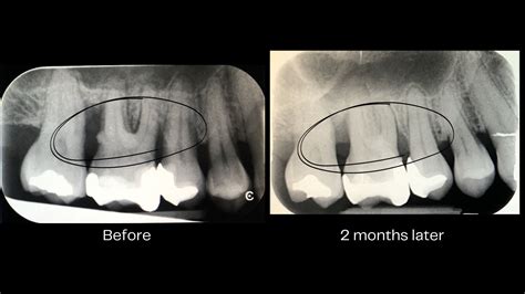 Report Title: Case Study - Successful Management of Advanced Periodontal Disease - Perio ...