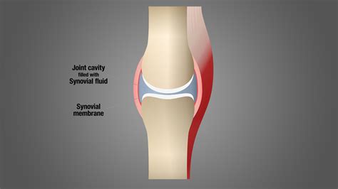 Why Do My Knees Crack When I Squat? Is it Dangerous? - Inspire US