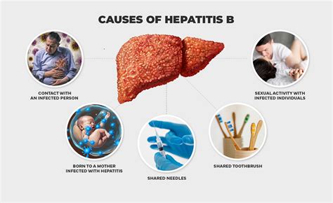 Hepatitis Causes