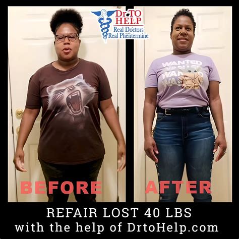 Phentermine Before And After