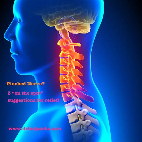 Pinched Nerve In Your Neck? Try 3 Things "On the spot". Once the pain is gone, call us for ...