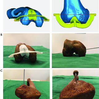 Image result for Piercing Guide Plate