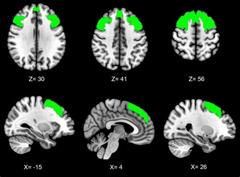 Image result for Dorsolateral Prefrontal Cortex
