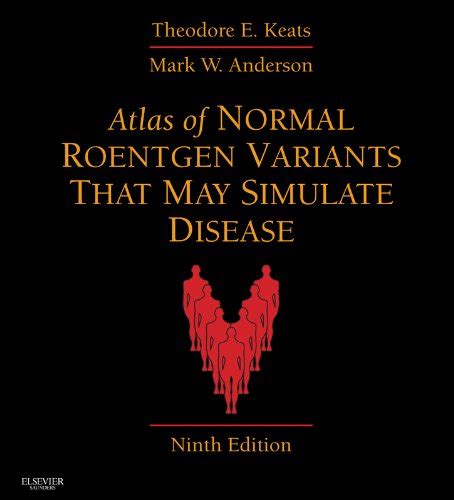Atlas of Normal Roentgen Variants That May Simulate Disease E-Book ...