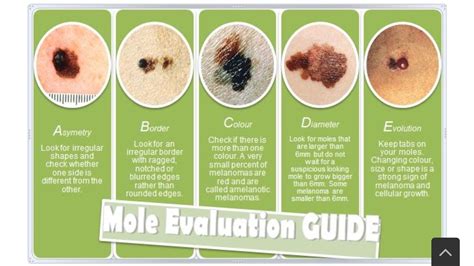 Age Spots Vs Skin Cancer