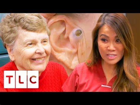 Image result for Exploding Zit Videos 2013