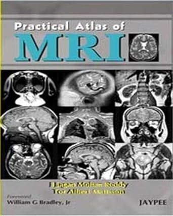 Buy Practical Atlas of MRI Book Online at Low Prices in India ...