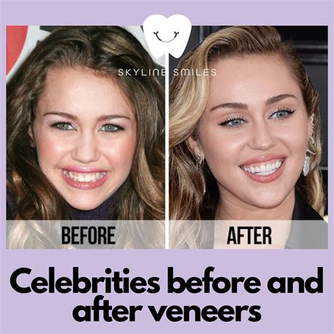 Skyline Smiles: Dr. Harleen Grewal, DDS | Achieving the perfect ...