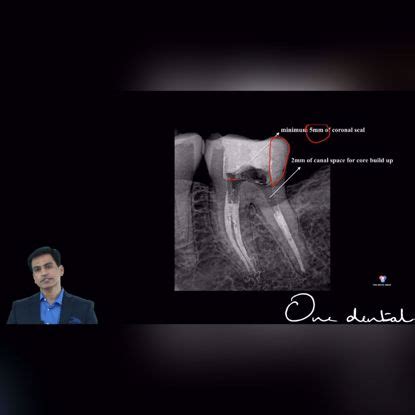 Short videos: The OD Clinical Skills Program-One Dental is the Biggest ...