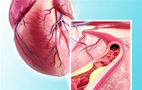 Image result for Ed Blood Flow Problems