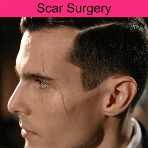 Face Scar Surgery Cost In India at Anthony Monroy blog